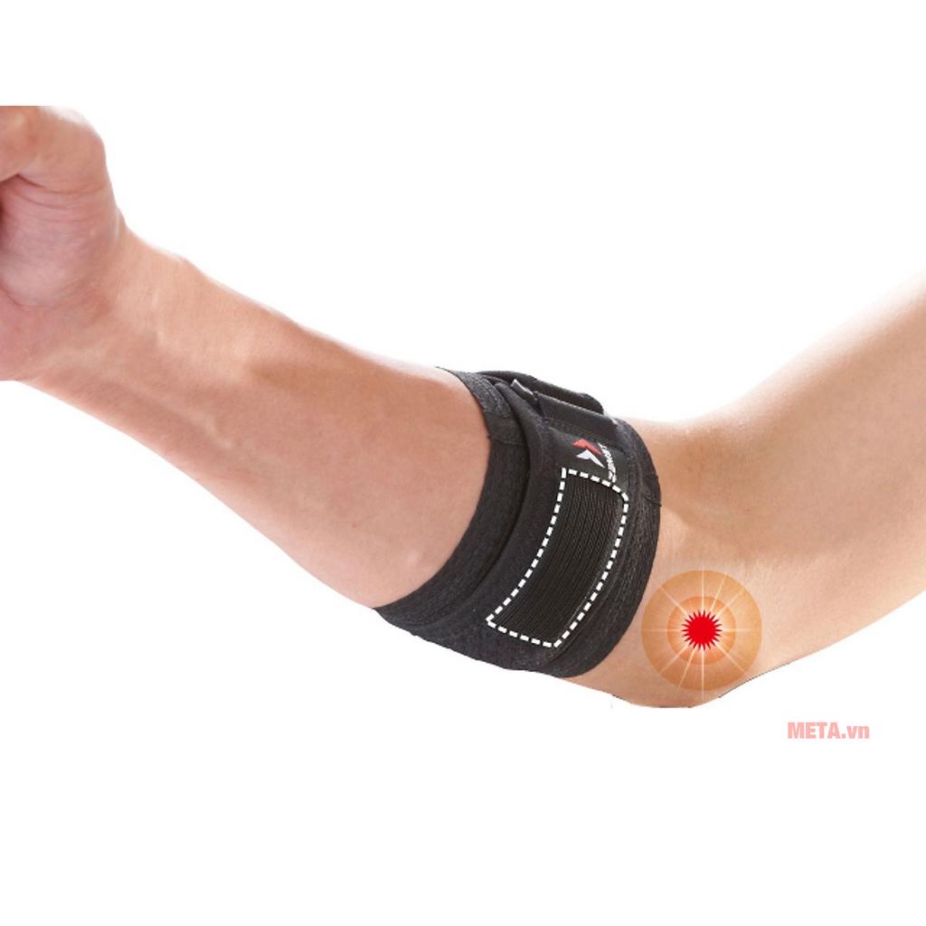 Miếng đệm giảm áp giúp giảm lực tác động lên gân khuỷu tay
