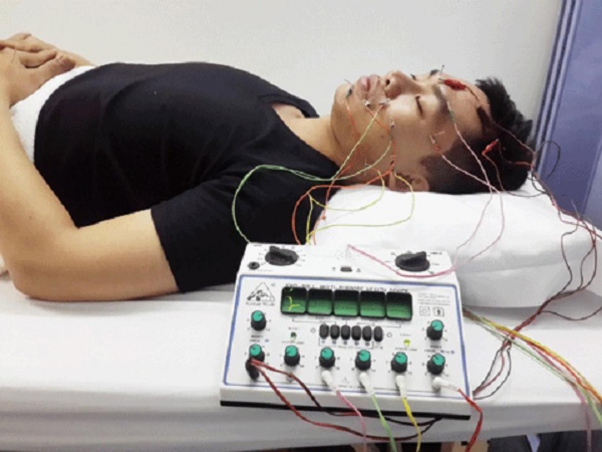 Bút dò huyệt hỗ trợ xác định vị trí châm cứu chính xác